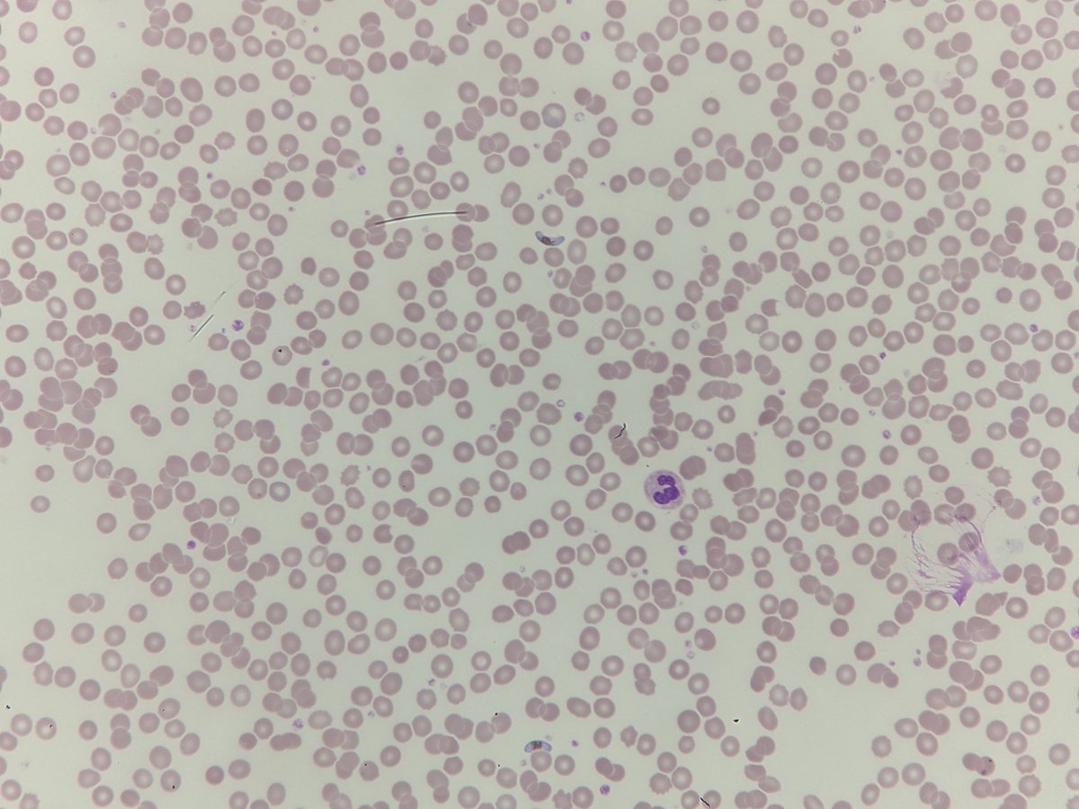BloodScientist's tweet photo. #FilmFriday

🦟➕🩸=🍌

Does this equation add up? 🤔🧐

#OnlyCells #RedCells #underthescope https://t.co/D2QYtPp2Cr