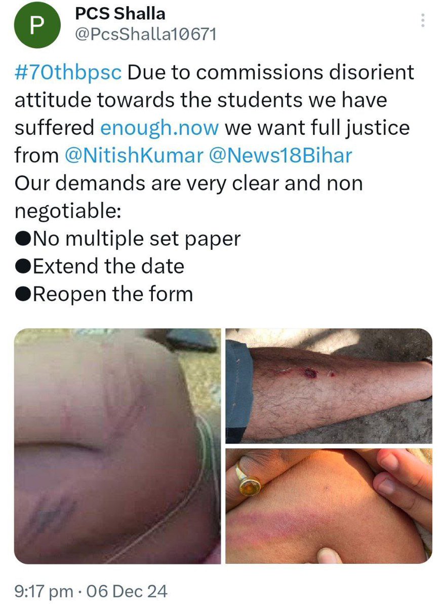 RishabhR_'s tweet photo. इन बच्चों को भी exam देना था chairman साहब  !
#BPSC_70th #BPSC @NitishKumar @yadavtejashwi @samrat4bjp @VijayKrSinhaBih @VijayKChy https://t.co/SxUj91exQp