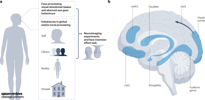 DiseasePrimers's tweet photo. #BodyDysmorphic disorder involves disturbances in emotional face processing, #visual attentional biases and aberrant eye gaze behaviours https://t.co/ONMSyiYj7P #NeuralProcessing https://t.co/8KZkzCAN7w