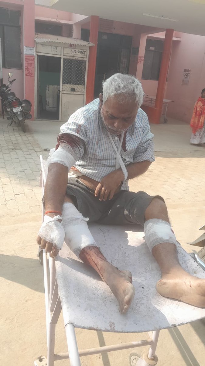 shannya35853's tweet photo. ब्राह्मण लड़की का रेप किया, मुकदमें में पुलिस को पैसा खिलाकर FR लगवा दिया। अब लड़की के पिता को किडनैप कर के दोनों हाथ और दोनों पैर रॉड से तोड़ा। क्या ये सच में योगी का उत्तर प्रदेश है। क्या किसी मीडिया में ये खबर चली?
@ShubhamShuklaMP @gyanu999 @BrahminComunity @VoiceOfBrahmins https://t.co/dOt5NrC3Qh