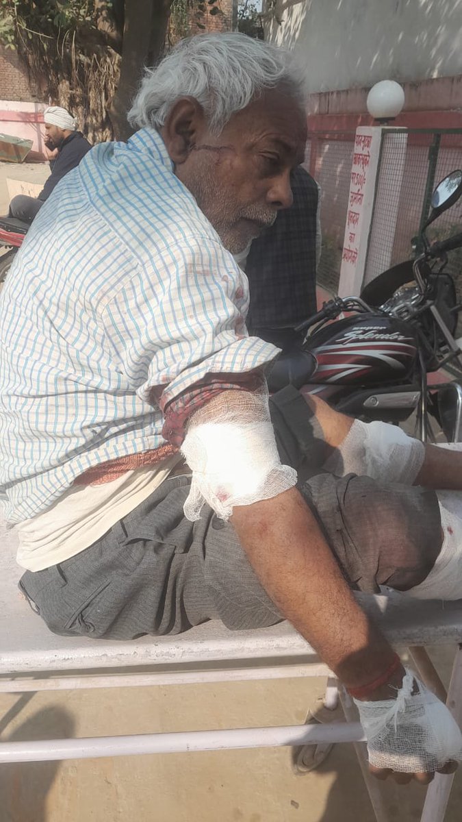shannya35853's tweet photo. ब्राह्मण लड़की का रेप किया, मुकदमें में पुलिस को पैसा खिलाकर FR लगवा दिया। अब लड़की के पिता को किडनैप कर के दोनों हाथ और दोनों पैर रॉड से तोड़ा। क्या ये सच में योगी का उत्तर प्रदेश है। क्या किसी मीडिया में ये खबर चली?
@ShubhamShuklaMP @gyanu999 @BrahminComunity @VoiceOfBrahmins https://t.co/dOt5NrC3Qh