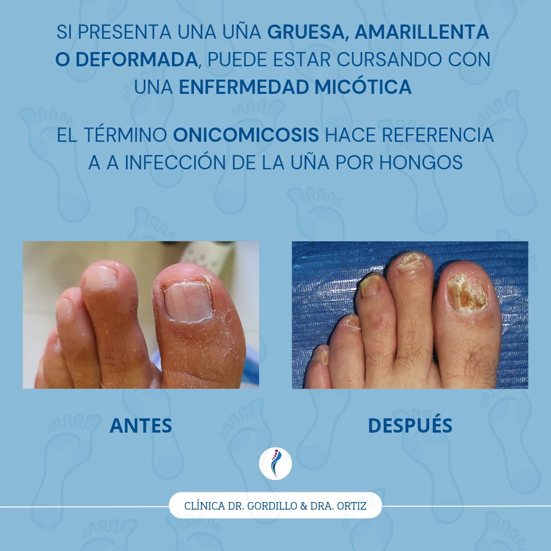 DoctoresDelPie's tweet photo. 👣 https://t.co/HKFML12oxL