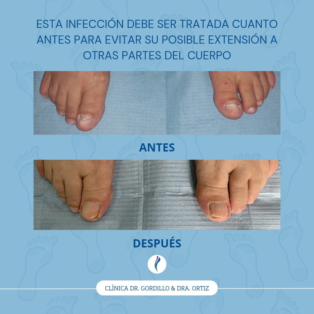 DoctoresDelPie's tweet photo. 👣 https://t.co/HKFML12oxL