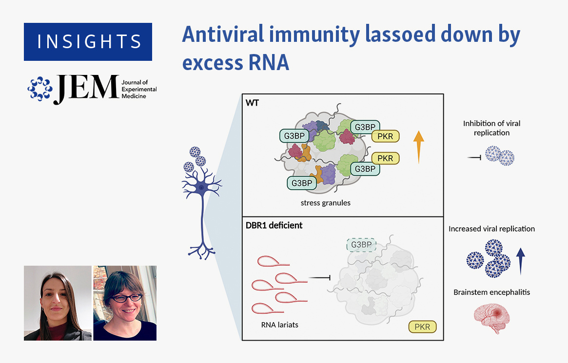 Journal of Experimental Medicine (@jexpmed) on Twitter photo Insights by <a href="/EV_Erika_/">Erika Valeri</a> & @KajasteLab: Two works by Chan et al. (hubs.la/Q02-JGLM0), and Ru et al. (hubs.la/Q02-JK4r0), identify defective RNA processing as the root cause of impaired antiviral immunity against #SARSCoV2 in the human brainstem. hubs.la/Q02-JRPf0 Insights by <a href="/EV_Erika_/">Erika Valeri</a> & @KajasteLab: Two works by Chan et al. (hubs.la/Q02-JGLM0), and Ru et al. (hubs.la/Q02-JK4r0), identify defective RNA processing as the root cause of impaired antiviral immunity against #SARSCoV2 in the human brainstem. hubs.la/Q02-JRPf0