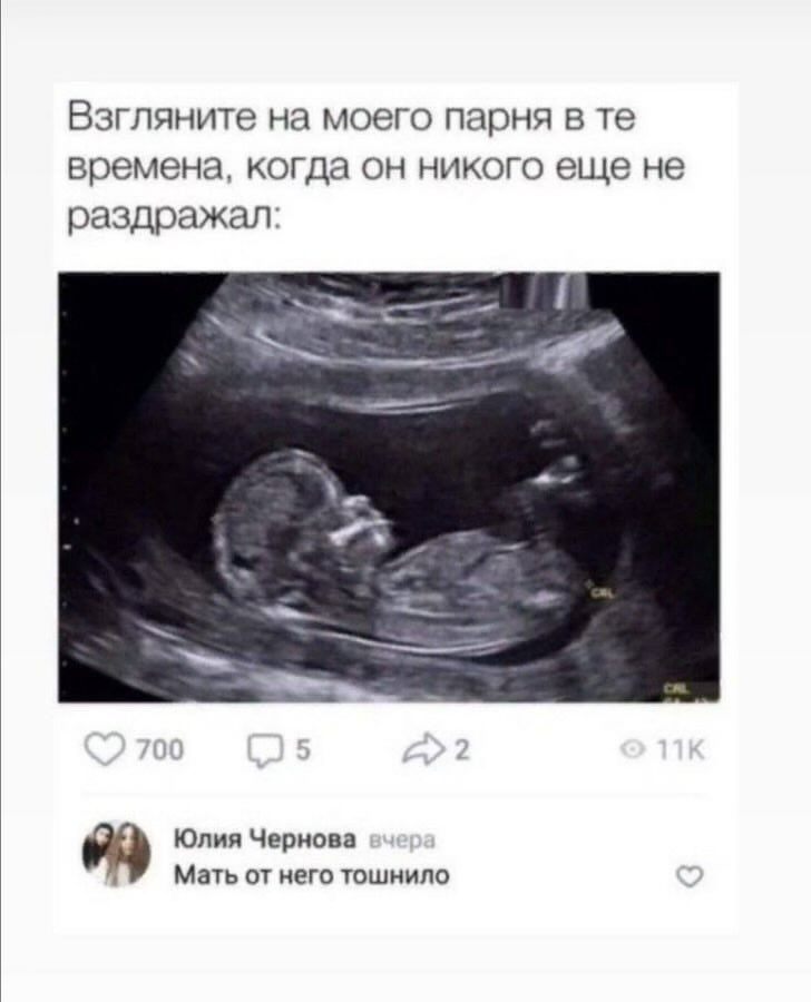 meinkoerperr's tweet photo. https://t.co/YEW5Bm3h69