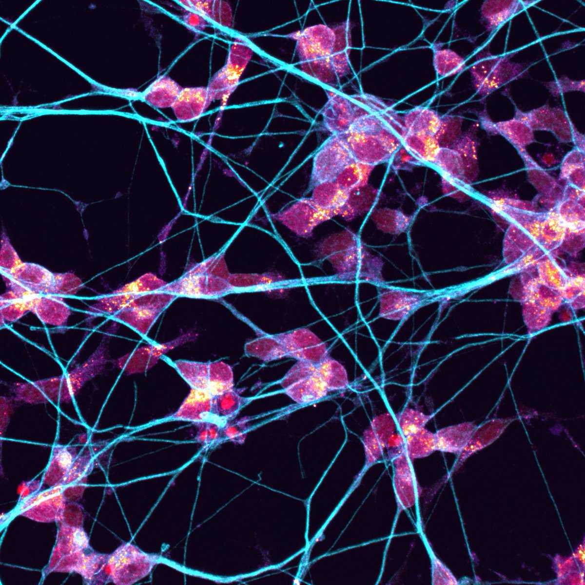 Sist0Angela's tweet photo. "Bonfire along cold paths" winner at the microscopy image contest @CMN_VIB . It's fun sometimes to play with my imagination #Microscopy #Neuron #Autophagy https://t.co/5G6Meews7W