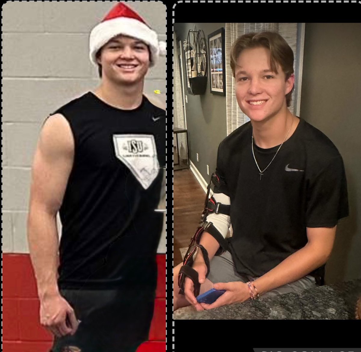 ILBraves's tweet photo. Before and After TJ Surgery for former IL Braves @Luke_Teschke
There’s 2 things that can happen when faced with such adversity. Feel sorry for yourself or take on yet another challenge in your life and become better from it. The best is yet to come! Proud of you #EatLiftRepeat https://t.co/G5SUFqnxjV