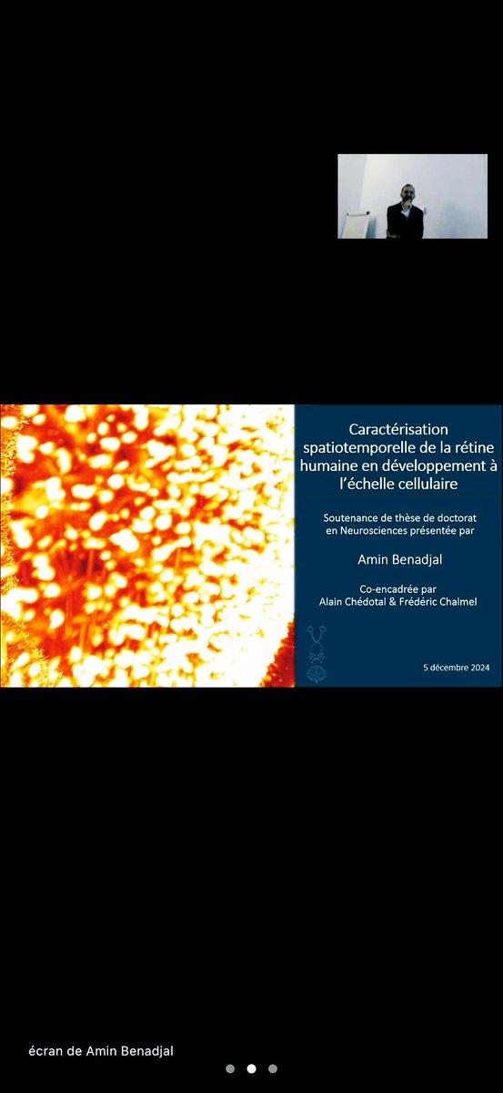 amin_benadjal's tweet image. Finally, I have obtained my PhD!👨‍🎓🥳
A successful first step in this journey as a researcher.🔬🧪👨‍🔬
#PhD #Neuroscience #neurodevelopment #retina