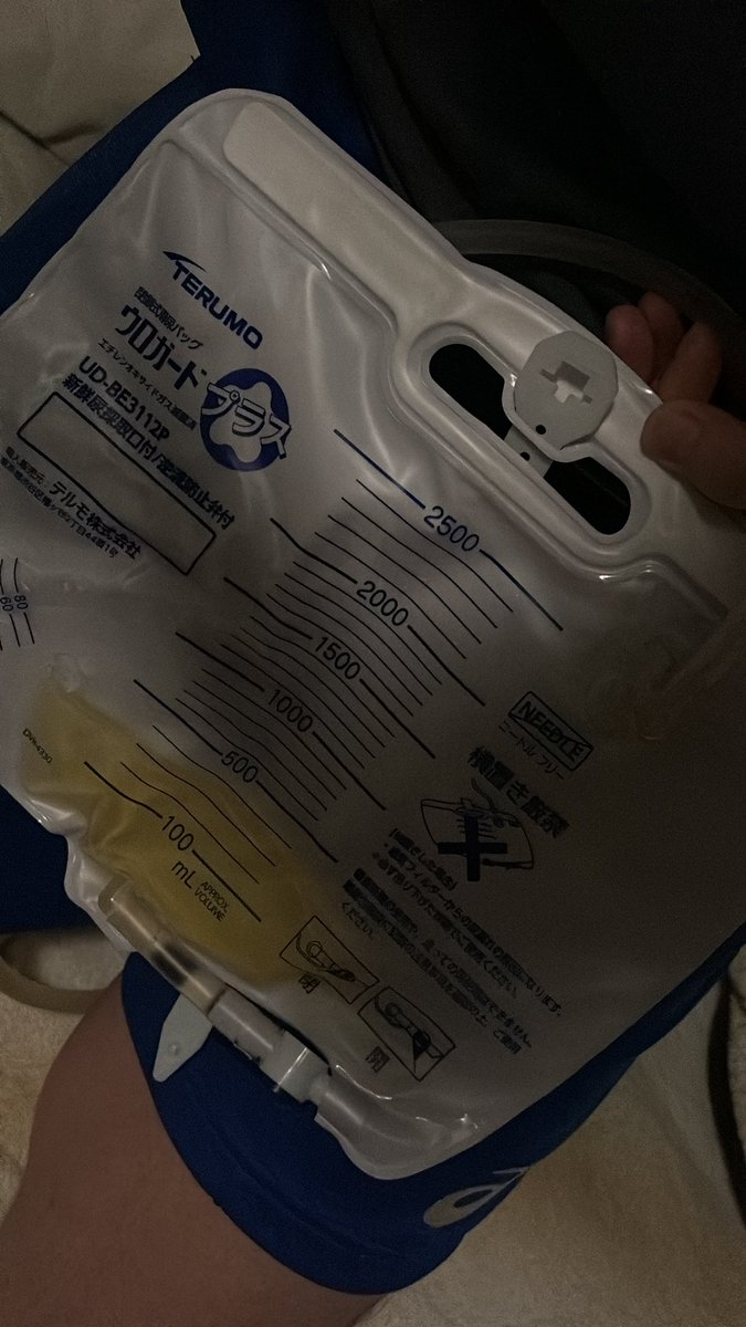 gu796's tweet photo. 初カテーテルやってみました👍
悪戦苦闘しながら何とか留置できました
明日になったらパンパンになってるかな？
#導尿
#カテーテル
#特殊性癖
#ユニフェチ https://t.co/Fr6tWuUSHP