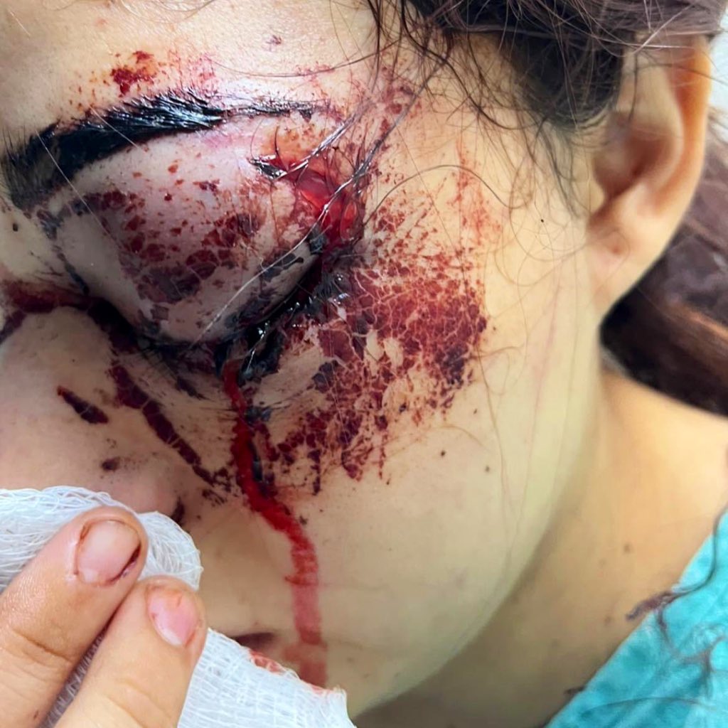 lamarlasabrina's tweet photo. 🚨 FUE CAPTURADO CHRISTIAN ROJAS

Pasante de medicina de 24 años que golpeó brutalmente a su entonces novia, Melanie Barragán, el 31 de octubre en Tamaulipas

Después de casi 36 días de búsqueda, fue detenido en Nuevo León

#JusticiaParaMelanie https://t.co/kzxgslStFM