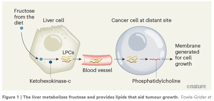 jsoriamd's tweet image. Fructose consumption has increased considerably over the past five decades, due to the widespread use of high-fructose corn syrup as a sweetener. A recent publication shows that fructose supplementation enhances tumor growth in various animal models. The liver converts dietary…
