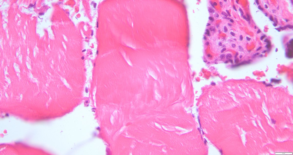 leon_metlay's tweet image. A puzzle for your weekend. Something doesn't belong. Anyone seen this before? What question would you ask?
#Pedipath #Placenta x2, x10, x20, x40