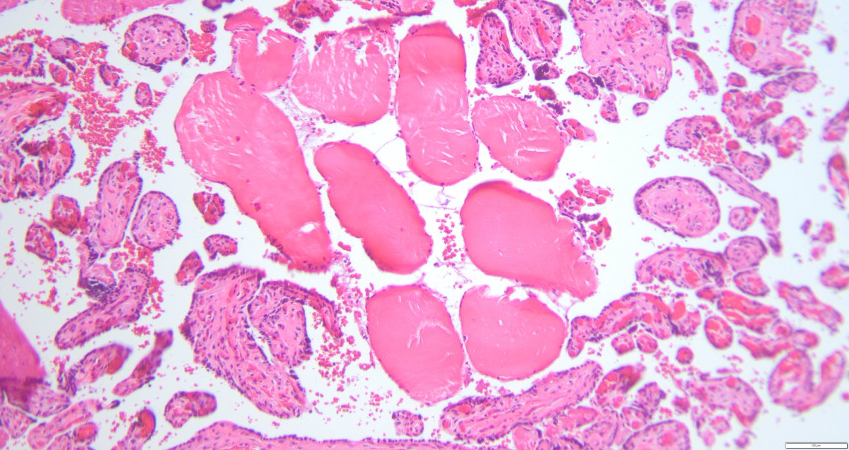 leon_metlay's tweet image. A puzzle for your weekend. Something doesn't belong. Anyone seen this before? What question would you ask?
#Pedipath #Placenta x2, x10, x20, x40