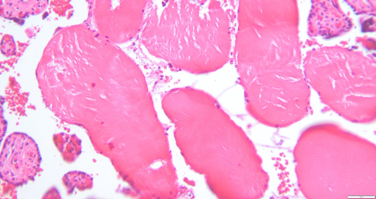 leon_metlay's tweet image. A puzzle for your weekend. Something doesn't belong. Anyone seen this before? What question would you ask?
#Pedipath #Placenta x2, x10, x20, x40