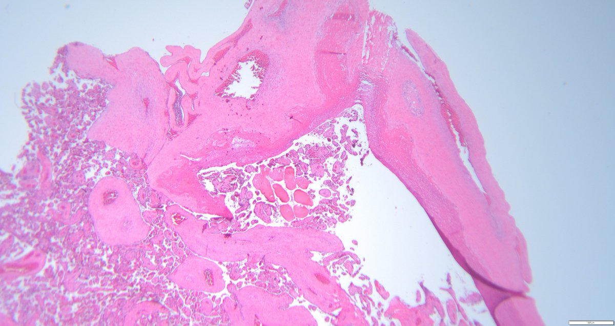 leon_metlay's tweet image. A puzzle for your weekend. Something doesn't belong. Anyone seen this before? What question would you ask?
#Pedipath #Placenta x2, x10, x20, x40