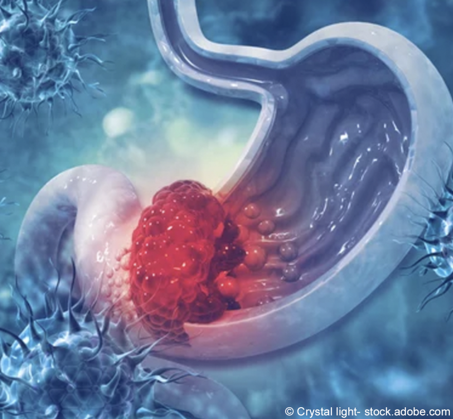 OncLive's tweet photo. Ushering more targeted therapies into the 2024 updates to the NCCN Clinical Practice Guidelines in Oncology for biliary tract cancers represented a notable advancement in the GI cancer space. @UCSFCancer #oncology #stomca https://t.co/XSA4CkzTcN https://t.co/dwpB2NeN99