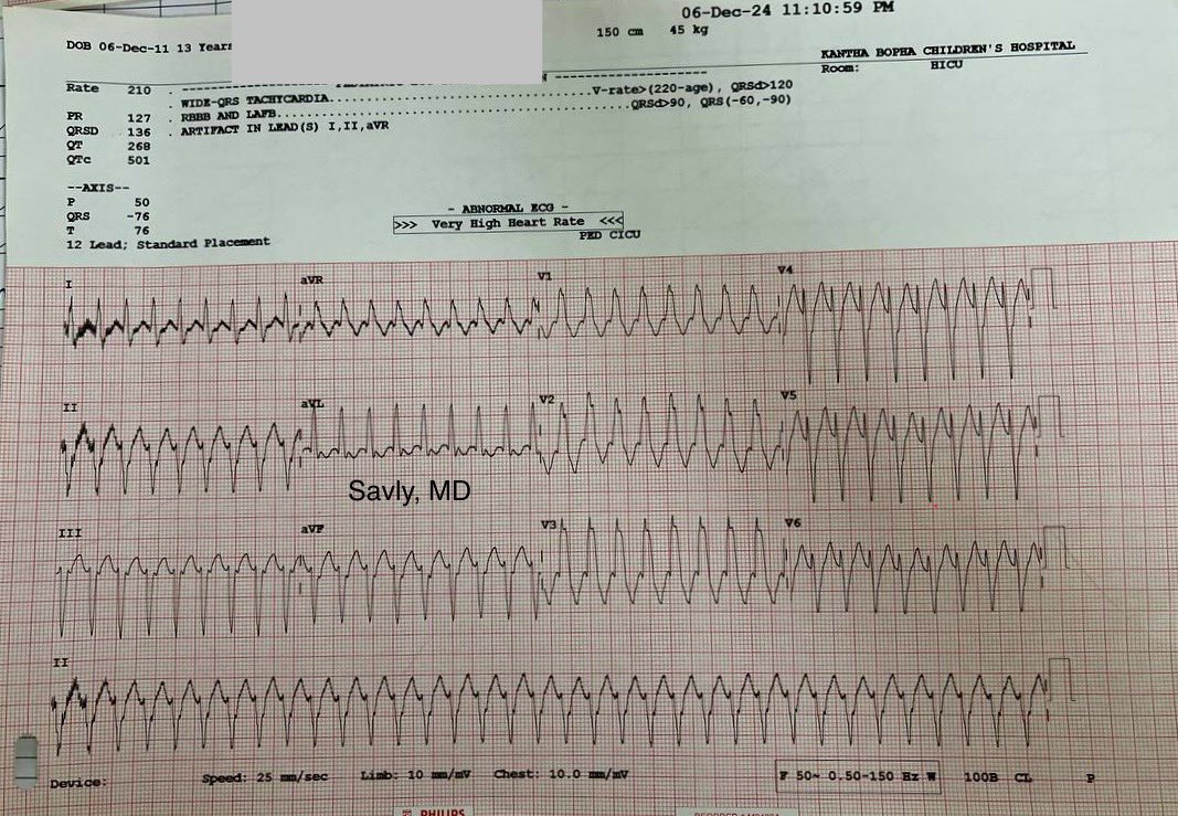 OungSavly's tweet photo. 13-year-old, Palpitations ❤️‍🩹@escardio @jeffrey_vinocur @RobertHPass @ecgandrhythmRoe https://t.co/JSkJRvJ2xH