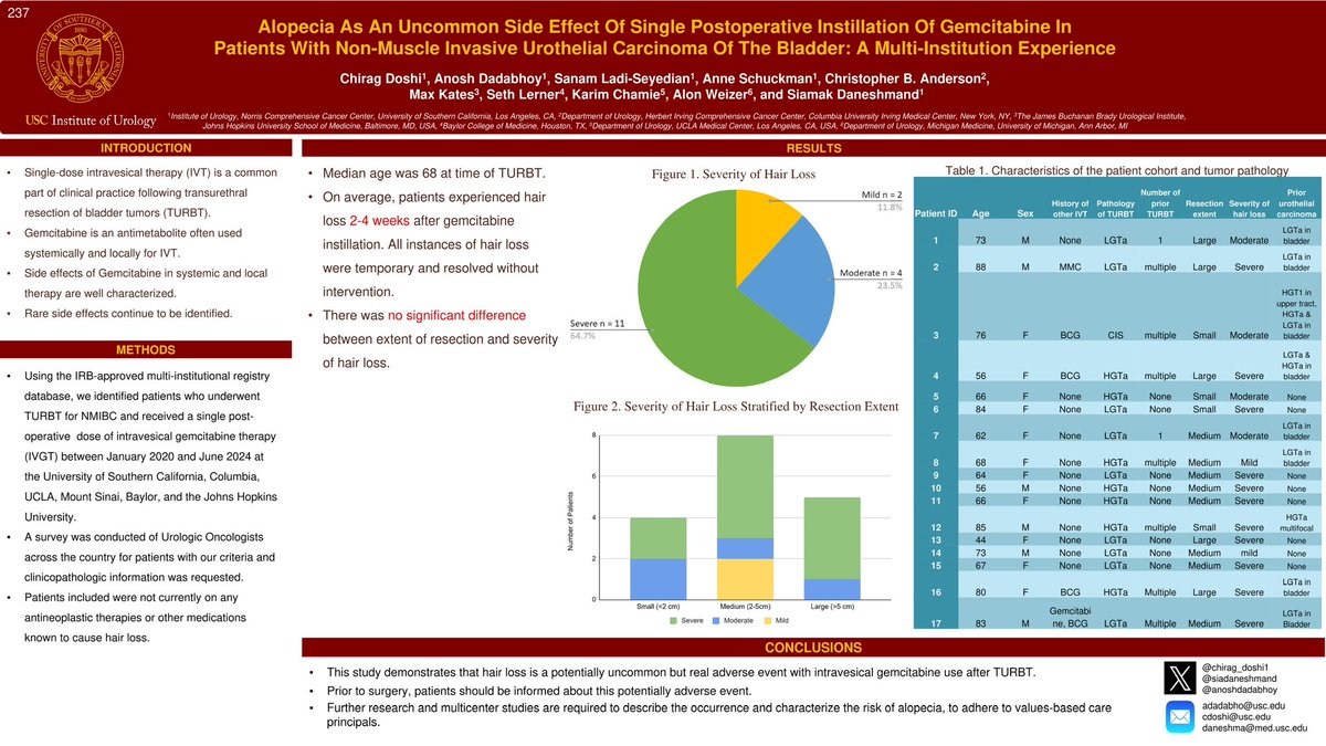 Chirag Doshi (@chirag_doshi1) on Twitter photo Thrilled to present our multi-institutional study on alopecia & intravesical gemcitabine #SUO2024
Thanks to our collaborators: <a href="/AnoshDadabhoy/">Anosh Dadabhoy</a> , <a href="/SanamLadi/">Sanam Ladi Seyedian</a> ,<a href="/AnneSchuckmanMD/">Anne Schuckman</a> ,<a href="/CBAnderson2014/">Chris Anderson</a> , <a href="/MaxKates/">Max Kates</a> , <a href="/slernerbcmedu1/">splernerMD</a> , Dr. Karim Chamie, Dr. Alon Weizer, and PI <a href="/siadaneshmand/">Sia Daneshmand, M.D.</a> Thrilled to present our multi-institutional study on alopecia & intravesical gemcitabine #SUO2024
Thanks to our collaborators: <a href="/AnoshDadabhoy/">Anosh Dadabhoy</a> , <a href="/SanamLadi/">Sanam Ladi Seyedian</a> ,<a href="/AnneSchuckmanMD/">Anne Schuckman</a> ,<a href="/CBAnderson2014/">Chris Anderson</a> , <a href="/MaxKates/">Max Kates</a> , <a href="/slernerbcmedu1/">splernerMD</a> , Dr. Karim Chamie, Dr. Alon Weizer, and PI <a href="/siadaneshmand/">Sia Daneshmand, M.D.</a>