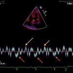 Photo by Sanjiv J. Shah, MD (@HFpEF)