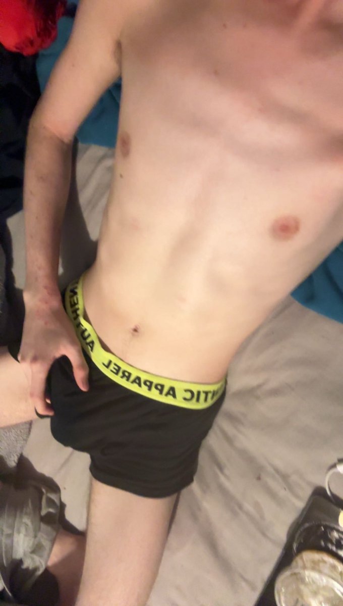 thathomotwink's tweet photo. Who wants to come sit on it?

#gay #bulge #nstw #gaynudes #gayboy #gaynsfw #gaytwink #gayuk #twink #body #skinny https://t.co/eSzykq8k1B