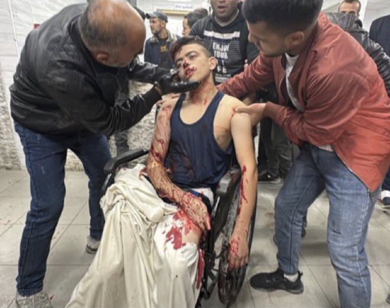 chelseahartisme's tweet photo. Israel shot a young man in a wheelchair who was waiting at the entrance of Kamal Awdan hospital for an X-Ray. 

Unarmed and in a wheelchair. 

16 years old.

Shot to death with your tax money.

Why has the world not stopped? https://t.co/xGVV85rWva