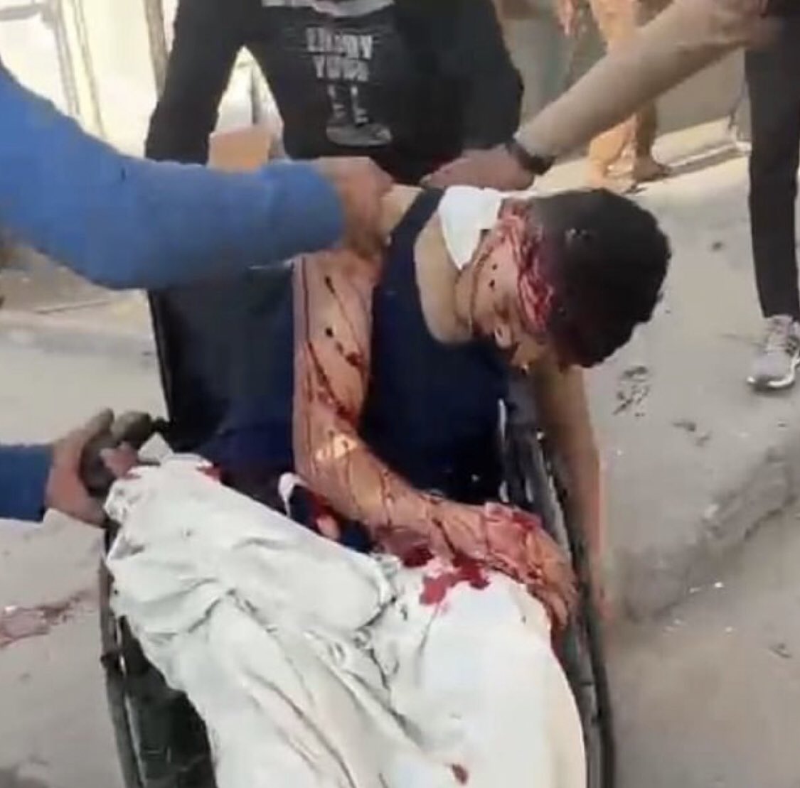 chelseahartisme's tweet photo. Israel shot a young man in a wheelchair who was waiting at the entrance of Kamal Awdan hospital for an X-Ray. 

Unarmed and in a wheelchair. 

16 years old.

Shot to death with your tax money.

Why has the world not stopped? https://t.co/xGVV85rWva