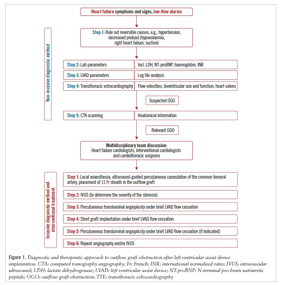 EuroInterventio's tweet photo. This study explored stent graft implantation for treating outflow graft obstruction in HeartMate 3 LVAD patients. This approach demonstrates safety and efficacy as a minimally invasive alternative to redo surgery, with no restenosis or migration observed after one year. https://t.co/CJw4CVSuLT  #EAPCI  #LVAD