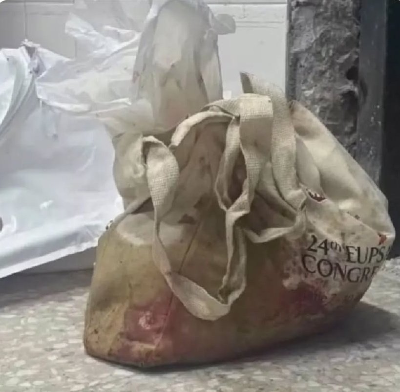 Çantanın içinde çocuk var‼️😭

Silahlar kadar, sessizlik öldürüyor❗

Gazze'nin çıkmayan sesi ol!..