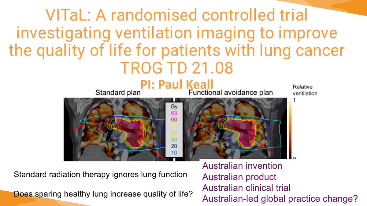 RadOncResearch (@hegifiona) on Twitter photo Such an honour to be asked to talk about <a href="/TROGfightcancer/">Trans Tasman Radiation Oncology Group</a> and be able to share our achievements in SABR, new technology and practice changing RCT with our Chinese colleagues at GCOG. <a href="/imagexinstitute/">Image X Institute</a> <a href="/PeterMacRadOnc/">Peter Mac Radiation Oncology</a> <a href="/DavidDbal/">David Ball AO</a> <a href="/_ShankarSiva/">Shankar Siva</a> Such an honour to be asked to talk about <a href="/TROGfightcancer/">Trans Tasman Radiation Oncology Group</a> and be able to share our achievements in SABR, new technology and practice changing RCT with our Chinese colleagues at GCOG. <a href="/imagexinstitute/">Image X Institute</a> <a href="/PeterMacRadOnc/">Peter Mac Radiation Oncology</a> <a href="/DavidDbal/">David Ball AO</a> <a href="/_ShankarSiva/">Shankar Siva</a>