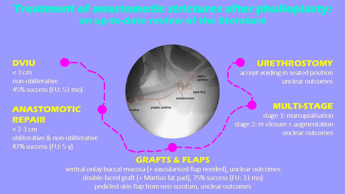 EAU YAU: Trauma & Reconstructive Urology (@eau_yaurecon) on Twitter photo Urethral strictures after phalloplasty most commonly occur at the anastomosis. In this paper, we provide a practical summary on how to treat them, for those interested! <a href="/wesley_verla/">Wesley Verla</a> <a href="/LumenNicolaas/">LumenNicolaas🇻🇦</a> <a href="/mwvetterlein/">Malte W. Vetterlein</a> 🙏
sciencedirect.com/science/articl… Urethral strictures after phalloplasty most commonly occur at the anastomosis. In this paper, we provide a practical summary on how to treat them, for those interested! <a href="/wesley_verla/">Wesley Verla</a> <a href="/LumenNicolaas/">LumenNicolaas🇻🇦</a> <a href="/mwvetterlein/">Malte W. Vetterlein</a> 🙏
sciencedirect.com/science/articl…