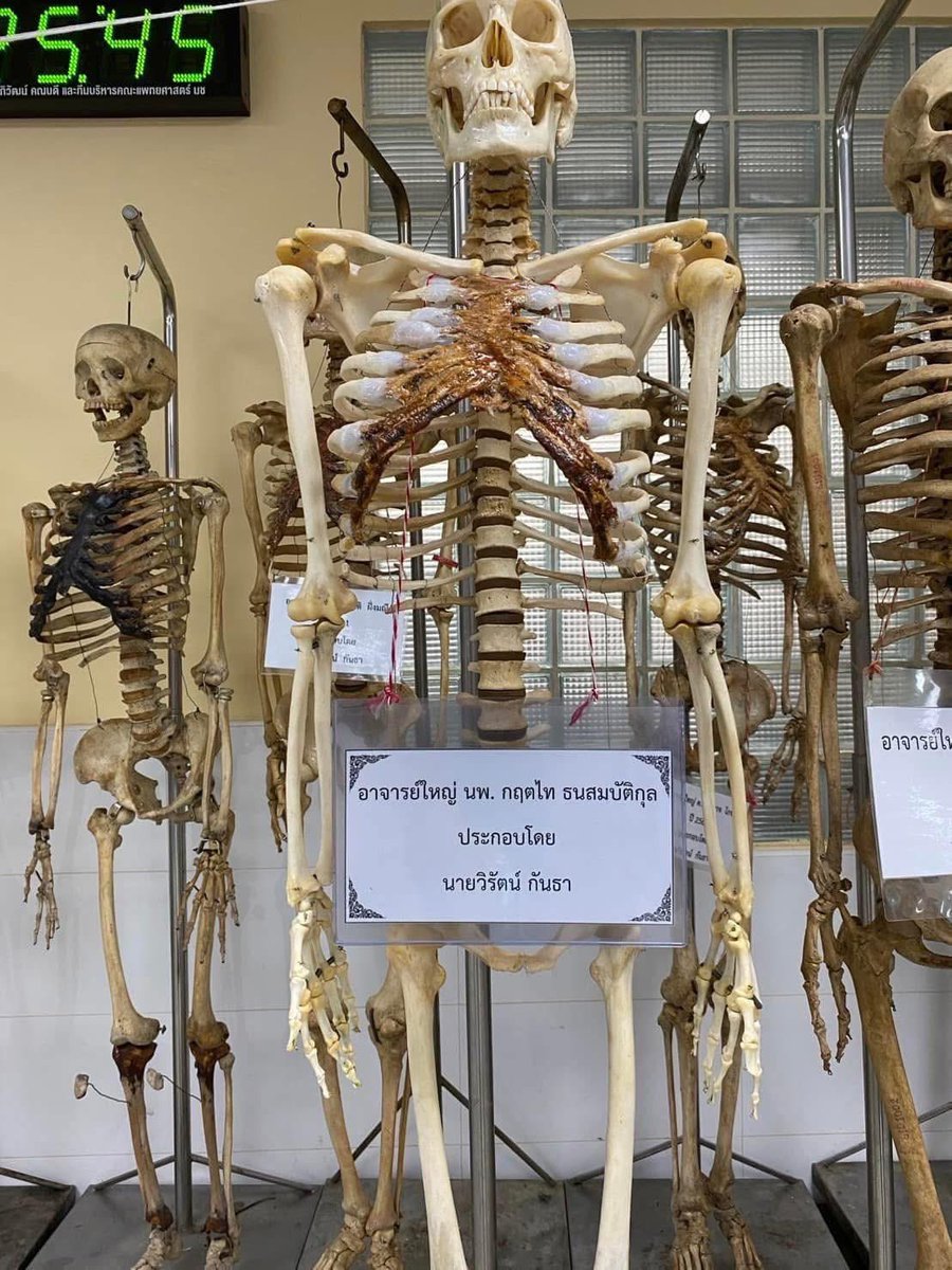 DjFiat's tweet image. อาจารย์ใหญ่
นพ.กฤตไท ธนสมบัติกุล

สิ่งสุดท้ายที่ฝากไว้
ก็ยังเป็นประโยชน์
ต่อคนข้างหลัง

#สู้ดิวะ