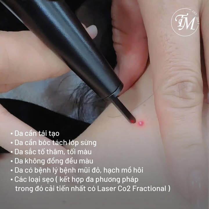FoundationMinT's tweet photo. Tết này Laser CO2 sẽ cho một làm dàn da vừa vặn đẹp đó ạ 😘
Chương trình sẽ kéo dài từ ngày 4/12 - 8/12, deal chỉ chạy 1 lần duy nhất, nên các bạn đừng bỏ lỡ nhé 🙆♀️
#MinTfoundation
#LaserFractionalCO2 #LaserCO2 #lasertrehoa #lasermun #laserseo #trehoada https://t.co/FCeGGNcgQx