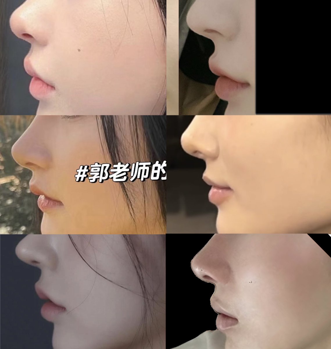 nyancoroyuyu's tweet photo. 【 鼻フル　理想 】

①正面
②斜め45度
③側面
④鼻〜人中にかけて

次は共通点探ししないと🫥 https://t.co/Wm7Ihwjjwt