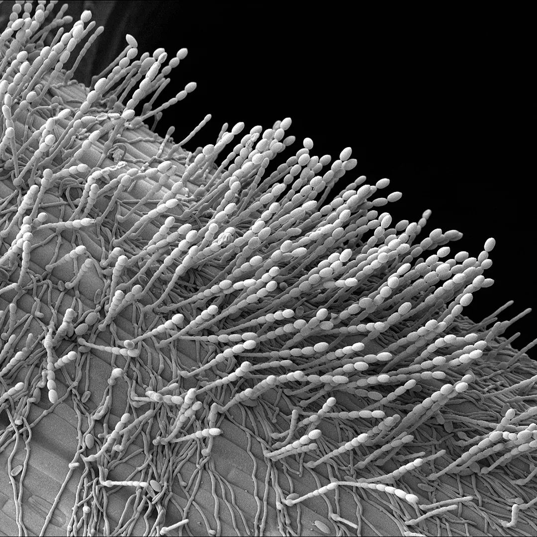 CzemborH's tweet photo. RT: Microscopy Australia @micro_au
"Spores of #powderymildew on a #barley leaf..." 
#fungus #spores
📷 our UQ facility @CMMUQ1
#microscopymondays #NCRISimpact
#Blumeriahordei #Blumeria #plantpathology 
#conidia #conidiophores #hyphae #mycelium #mycology #resistance #epidemiology https://t.co/2Mho1EiUCQ
