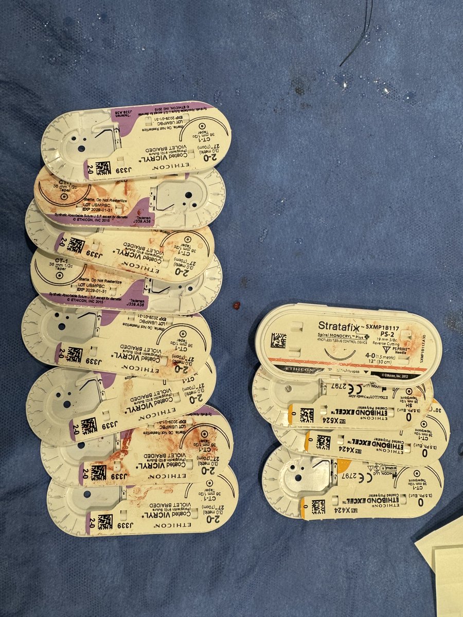 Pattara Rattanawong, MD, FACC, FHRS (@pat_nawong) on Twitter photo Successfully implanted a subcutaneous ICD in a 450 lbs patient! What’s the highest BMI or most challenging body habitus you’ve worked with? Best outcome impedance in such cases? #Epeeps <a href="/DanMoritaBSC808/">daniel morita</a> Successfully implanted a subcutaneous ICD in a 450 lbs patient! What’s the highest BMI or most challenging body habitus you’ve worked with? Best outcome impedance in such cases? #Epeeps <a href="/DanMoritaBSC808/">daniel morita</a>