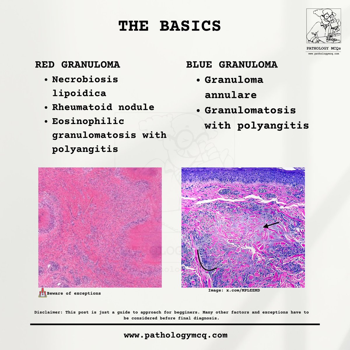 Pathology_mcqs's tweet photo. Understanding Palisading Granulomas: Decoding ‘Blue’ and ‘Red’ Granulomas in Skin Histology 🩸🔬

🩺 Learn about necrobiotic processes, mucin deposition, and more.
🔗 Explore detailed breakdowns at https://t.co/h3oCpw3WEr

#pathologymcqs #Histology #pathboards #Granulomas https://t.co/SHEvGNEg8l