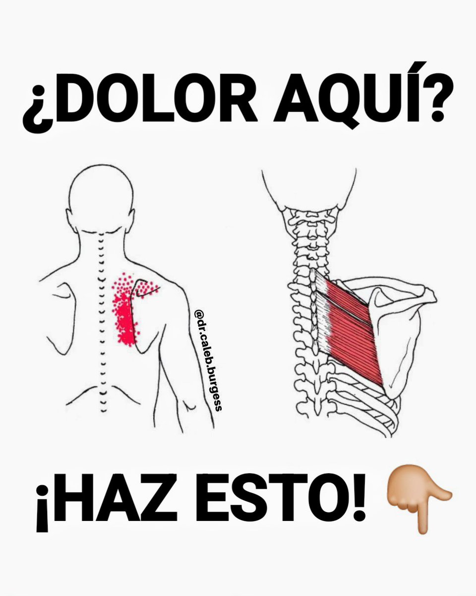NOgymNOlimits's tweet photo. ¿Dolor aquí?........ Haz esto 👇🏼 https://t.co/8IHl5BuYtZ