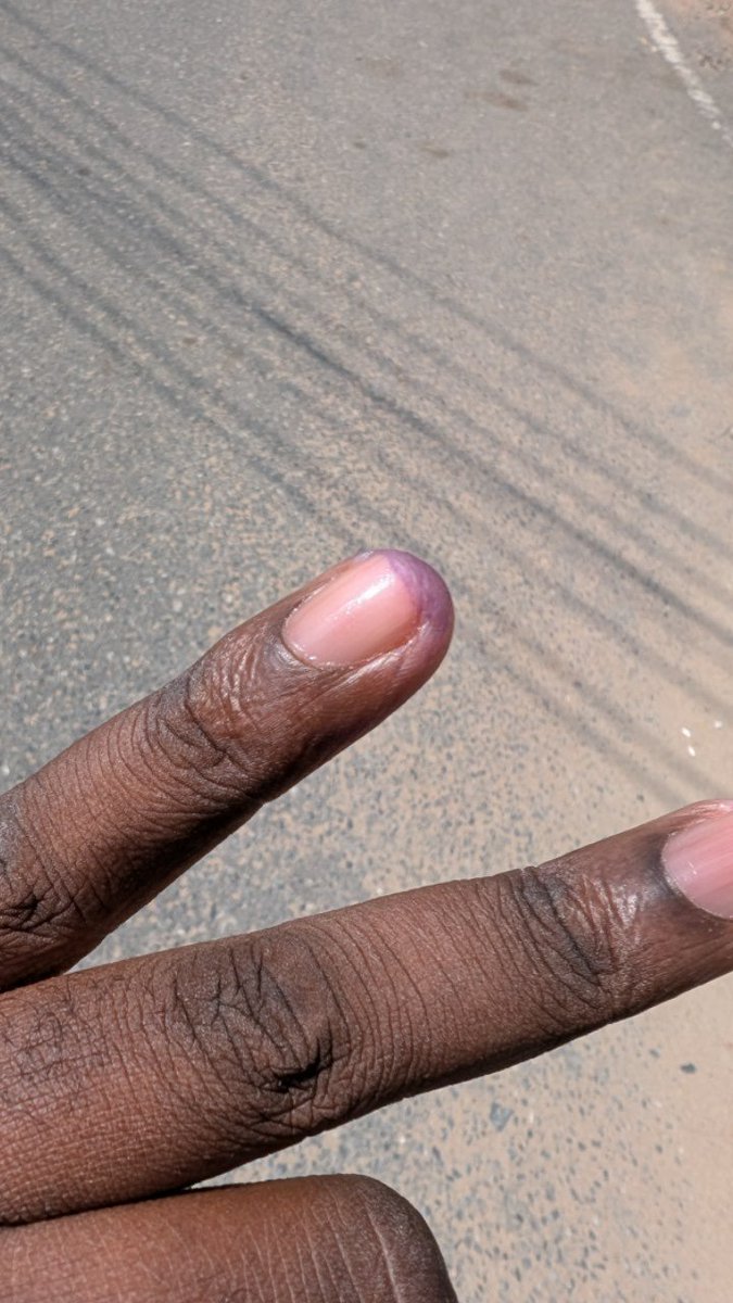 WikimediaGH's tweet photo. Ghana heads to the polls today to elect a new set of leaders to run the country for the next four years.

Have you voted already?

#GhanaDecides #WikimediaGH #GhanaPolls2024 https://t.co/ANrASU2oiZ