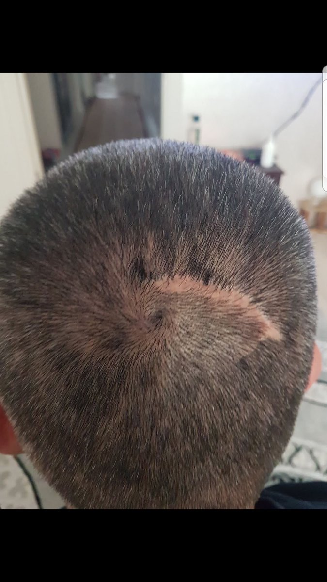 DurmuGk5's tweet photo. @UlviYonter Sayin başkanim terörle mucadelede yaralanip gazi sayilmayan devletin hiç bir şeylerinden faydalanmiyan 20 bin kahramanlara,gazi lik sözü verdiniz sayin devlet bey söz verdi 8 yilsan beri calişmalar bitmedimi https://t.co/eKnWEME3B0