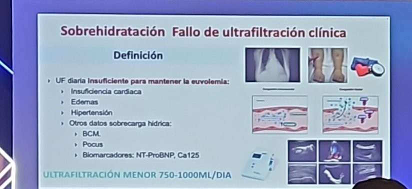 AvelRomanNeph's tweet image. Cómo definimos la falla de #UF?

¿Qué herramientas tenemos?

#IMIN2024 #PDFirst 

@IMINmx