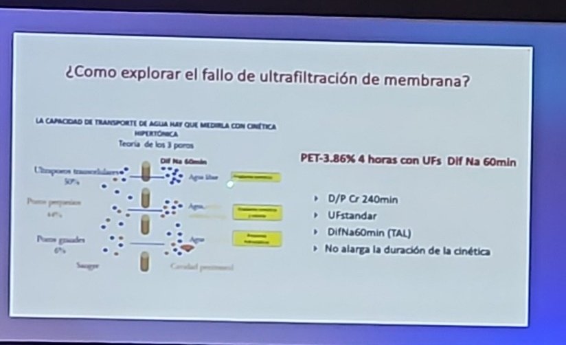 AvelRomanNeph's tweet image. ¿Cómo funciona la #UF?

Modelo distributivo

#PDFirst #PeritonealDialysis #Nephrologist 

@IMINmx @ISPD1