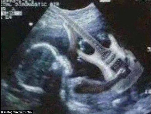 chockkydaman's tweet photo. parents: is it a boy or a girl??

doctor: NAHH BRO IT’S A SIGMAAA!! 🗣️🗣️ https://t.co/L3Uph1BesJ