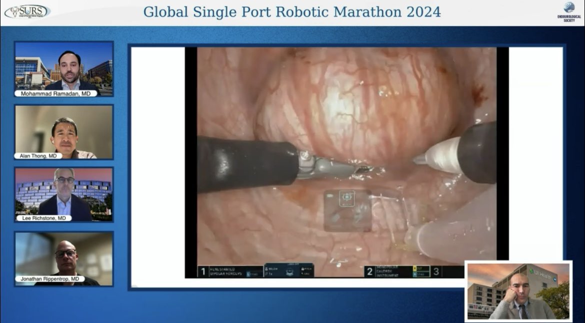 Riccardo Autorino MD PhD FACS (@ricautor) on Twitter photo Great video demo of robotic STEP procedure π <a href="/TheMobotMD/">Mohammad Ramadan</a>
Kudos ππ» <a href="/SimoneCrivella2/">Simone Crivellaro</a> <a href="/drjkaouk/">Dr. J. Kaouk</a> for a π #SPmarathon program π€π―π
<a href="/SocietySURS/">Society of Urologic Robotic Surgeons (SURS)</a> #SPARC Great video demo of robotic STEP procedure π <a href="/TheMobotMD/">Mohammad Ramadan</a>
Kudos ππ» <a href="/SimoneCrivella2/">Simone Crivellaro</a> <a href="/drjkaouk/">Dr. J. Kaouk</a> for a π #SPmarathon program π€π―π
<a href="/SocietySURS/">Society of Urologic Robotic Surgeons (SURS)</a> #SPARC