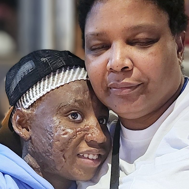 traniya03's tweet photo. @Pastor__West My family is in desperate need of support during this very difficult time. My granddaughter was burned 80 percent of her body 3rd degree. Eight months later,we're still in ICU
#helpsupport #burnedgrandchildren
#donatenow #broken
https://t.co/NwUCBAOJ32 https://t.co/C1PTcLQAIL