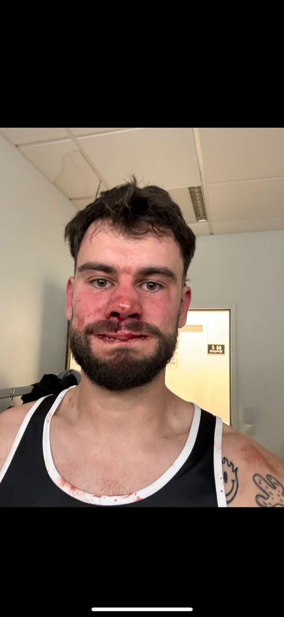 KemoBrs's tweet photo. Je suis KO y’a un mec il a dit Prime il pouvait terminer Bouzi à la pioche #DTRFight https://t.co/m1V9gKsukr