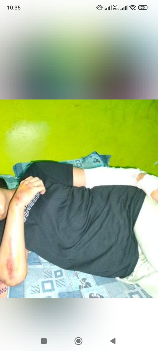 Filterfufa's tweet image. इस लडकी की सुनो पुकार 
डेट बढाओ अबकी बार
 #reopen70thBpscForm