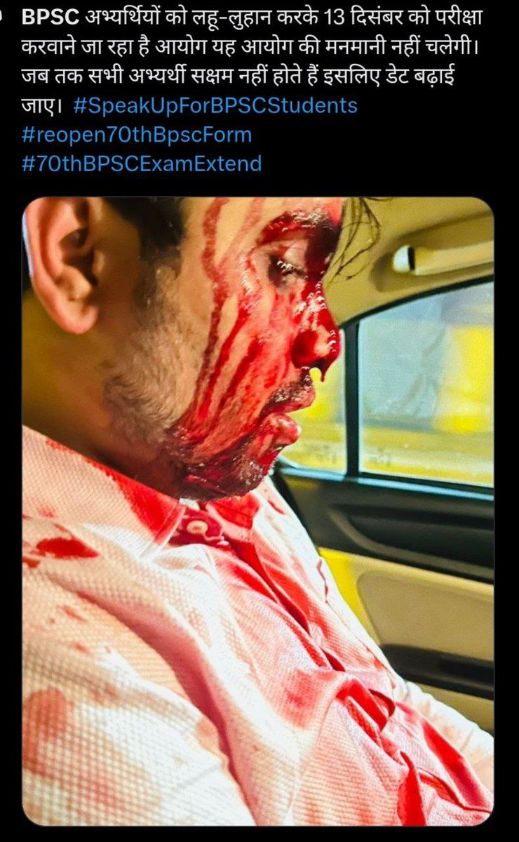 sunny4200000000's tweet photo. हुत सारे अभ्यर्थियों का रजिस्ट्रेशन होने के बाद भी आवेदन नहीं हो सका है इसलिए एप्लिकेशन विंडो रीओपन किया जाय । परीक्षा तिथि भी एक महीने आगे बढ़ाई जाय ।
@NitishKumar @SanjayJhaBihar @VijayKrSinhaBih @VijayKChy 
 #Reopen70thBPSCForm https://t.co/wLLycwQ3tJ