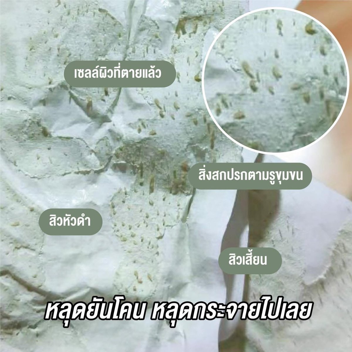 opkaiaoo's tweet photo. โอ้ว ! ออกเยอะมาก สิ่งอุดตันที่อยู่บนหน้า 🙀
รู้เลย…สิวขึ้นได้ไง 
.
179 บาท คุ้มมาก ใช้ได้ทั้งหน้า 
( แถมกระดาษ  50 แผ่น ) https://t.co/5hQl0IzEMB