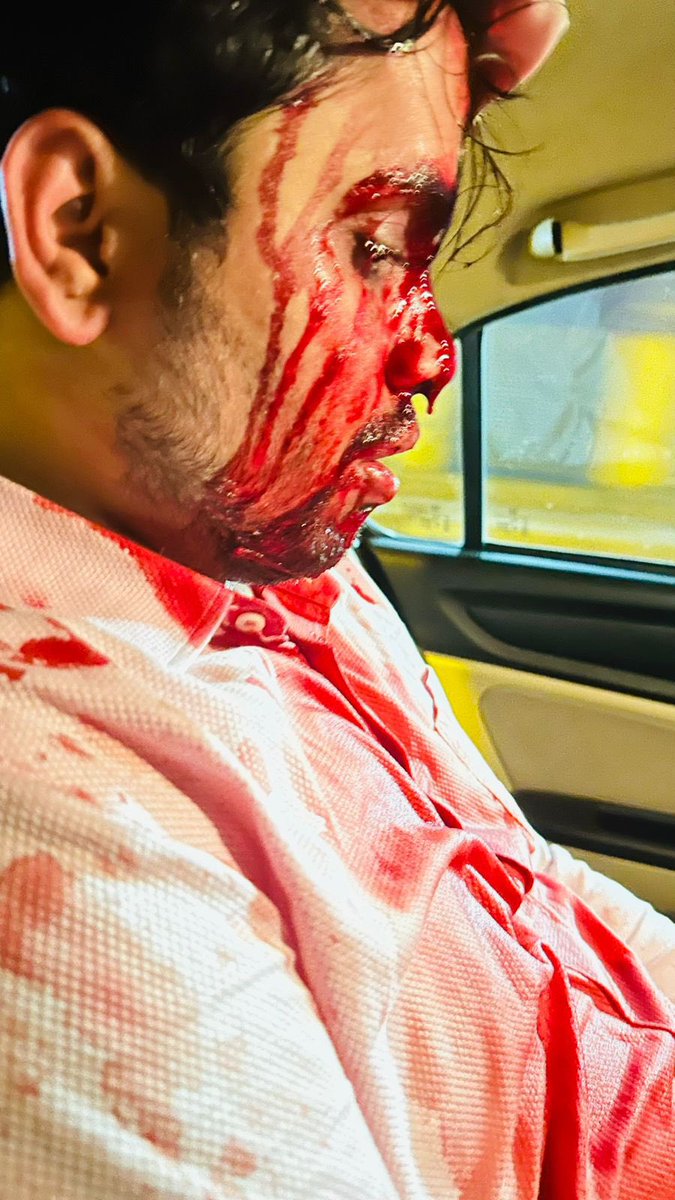 MdKarimDidar's tweet image. Fight for the exam, then get beaten up and celebrate democracy.

#ssc_reform #SSC_marks_public

#SSC_SCAM #SSC_STOP_SCAM

#reopen70thBpscform
#SSC_STOP_SCAM