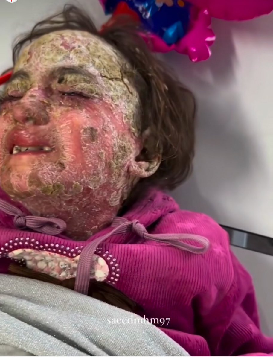 Mosab Abu Toha tweet media